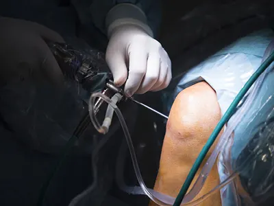 midsection-doctor-doing-knee replacement surgery on patient in hospital